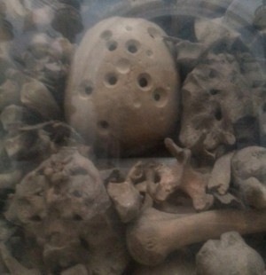 Cráneo trepanado de un santo mártir de Otranto.